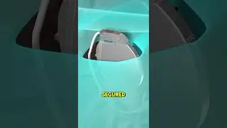 Как имплантируется кардиостимулятор? #3danimation#кардиостимулятор #кардиология #здоровоесердце