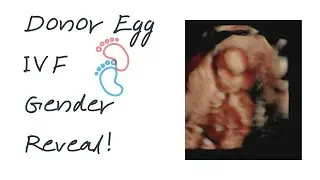 Donor Egg IVF Success Gender Reveal!