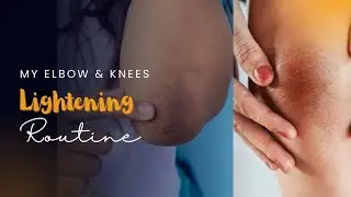 Dark Elbows, Knees, Finger side area Clearing Routine | Get Clear Skin Around Elbows #skincare