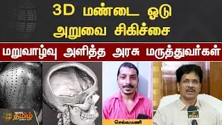 3D மண்டை ஓடு அறுவை சிகிச்சை... மறுவாழ்வு அளித்த அரசு மருத்துவர்கள் | Chennai | 3D Operation