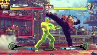 ULTRA STREET FIGHTER IV Dudley (Slay) vs Sagat (Mika)
