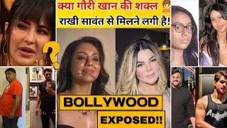 Bollywood's FAKE Beauty EXPOSED! | Botox, Fillers & Ozempic Truth | #bollywood #botox #ozempic #fy 