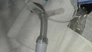 Trach tube;How does a trach tube look like?