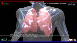 Electricidad efectos en el cuerpo humano