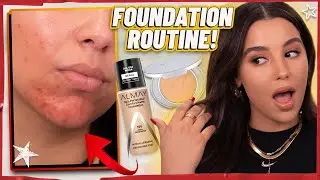 HOW I COVER MY ACNE AND BLEMISHES USING AFFORDABLE MAKEUP *Acne Coverage Foundation Routine*