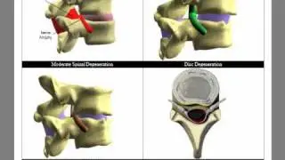 Virtual Consultation Version 8.4 Demo.mp4