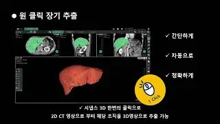 Synapse 3D 소개 (Narration) - FUJIFILM (주)신기사