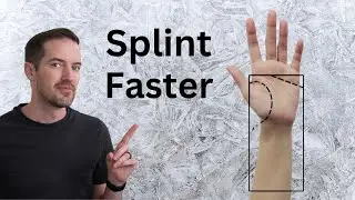 How to splint faster in Hand Therapy