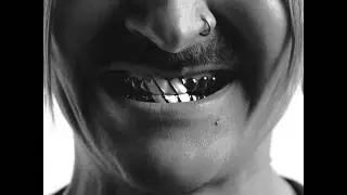 LITTLE BIG – DAS ADIDAS (Official Music Video)