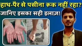 हाथ-पैर से पसीना क्यों आता है? जानिए Hyperhidrosis का पक्का इलाज | Sweaty Hands & Feet Treatment