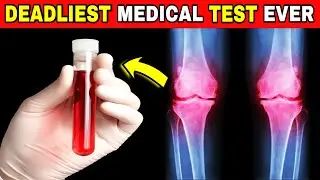 NIGDY NIE PODDAWAJ SIĘ TEMU TESTOWI! 7 powszechnych i niebezpiecznych badań lekarskich (kt&oacute;rych n...