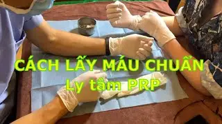 Nguyên lý Rút máu làm PRP và quy trình tách PRP chuẩn | Quy trình ly tâm PRP Dr Ninh