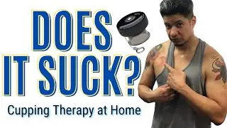 Should You Consider Cupping Therapy?