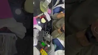Class ll mod.1 part 1{design & bite & mounting  Acrylic RPD طب أسنان مرحلة ثالثة }