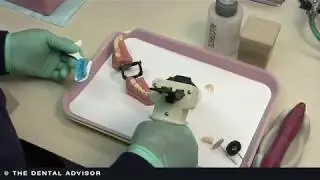 From the Field - Fabricating a Temporary Crown: Part 1