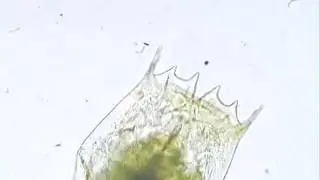 Rotifer, Brachionus bidentatus .wmv