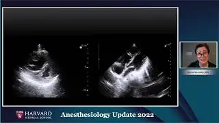 35  Everyday Pocus For Ambulatory Anesthesia