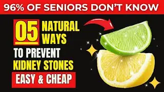 5 BEST Method to Prevent Kidney Stones Naturally: Diet and Hydration Tips