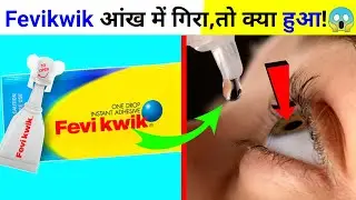 आंख में Fevikwik गिर गया😭 || facts || fact video hindi || #fact #human #fevikwik
