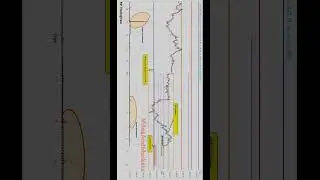 &ldquo;Colgate Palmolive: 4H Fib Support to Intraday Breakout - Exact Buying Zone,Volume | MilesAndMarkets