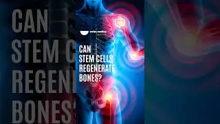 Can stem cells regenerate bones? #stemcell #bone #regeneration #shorts