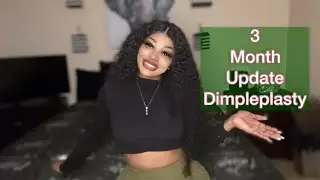 Dimpleplasty 3 month update!!! Am I done healing???