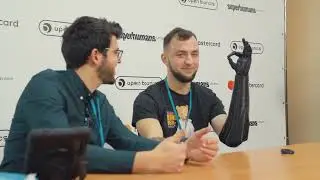 Перші пацієнти клініки Superhumans (м. Львів) &ndash; встановлення протезів OpenBionics