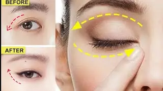 Easy Cat Eye Lift Exercise _ Eye lift, Eyelid lift, Fix Droopy eyelids and Remove eye wrinkles
