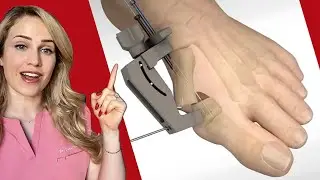 Foot surgeries explained in 30 seconds (3D ANIMATIONS)