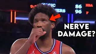 Joel Embiid Can&rsquo;t Blink His Eye - Doctor Reacts