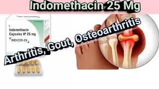 Indomethacin 25 Mg | Arthritis And Gout | Side Effect And Indication | MTB |