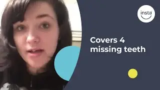Tabetha's Story: Covering 4 Missing Teeth | Instasmile Review