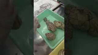 Cerebellum peduncles part 1