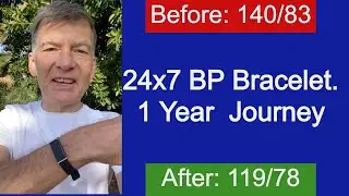 24x7 blood pressure monitor review | Aktiia BP bracelet 1 year journey