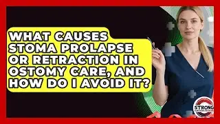 What Causes Stoma Prolapse Or Retraction In Ostomy Care, And How Do I Avoid It?
