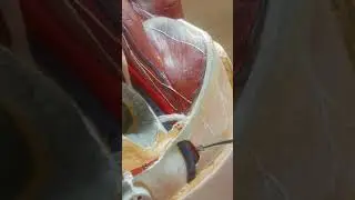 Aorta Abdominalis Anatomisi