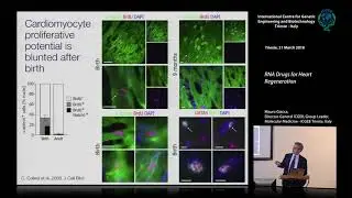 M. Giacca - RNA Drugs for Heart Regeneration