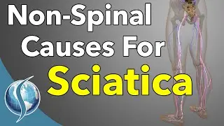 Non-Spinal Causes Of Sciatica