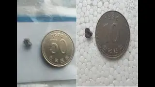 실제 요로결석 환자가 말하고 보여주는 요로결석