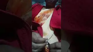 na idea miku nachindha 🥰😔🤗#please support me#like#suscrber #shots#viral#