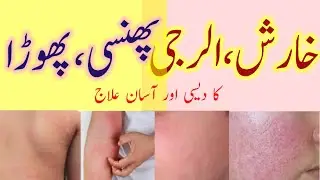 kharish, allergy, phunsi, phora ka desi aur asaan ilaj || itching, allergy, boil, abscess.