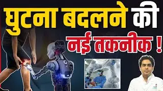 Robotic Joint Replacement कैसे होता है? पूरा प्रोसेस समझिए | Dr. Sanjay Kapoor