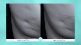 ▶ Introducing NeriumFirm  The latest in skincare hq