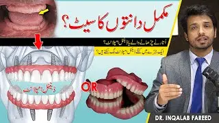 Dental Implants or Removable Denture What's the BEST Solution for You?
