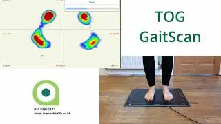 How do you do the GaitScan for orthotics at Avenue Health?