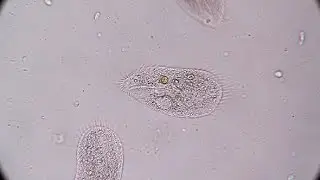 Stylonychia Ciliophora 04 | Stock Footage - Videohive