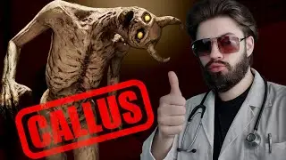 СПЕЦ ПО МОЗОЛЯМ !!! - CALLUS !!!
