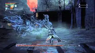 Bloodborne&trade; - Darkbeast Paarl boss fight