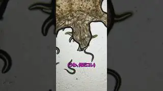 体の衝撃的な秘密&hellip;