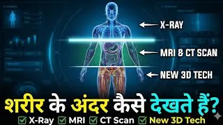 शरीर के अंदर कैसे देखते हैं? X-Ray, MRI, CT Scan और नई 3D तकनीक Explained | Vigyanfact